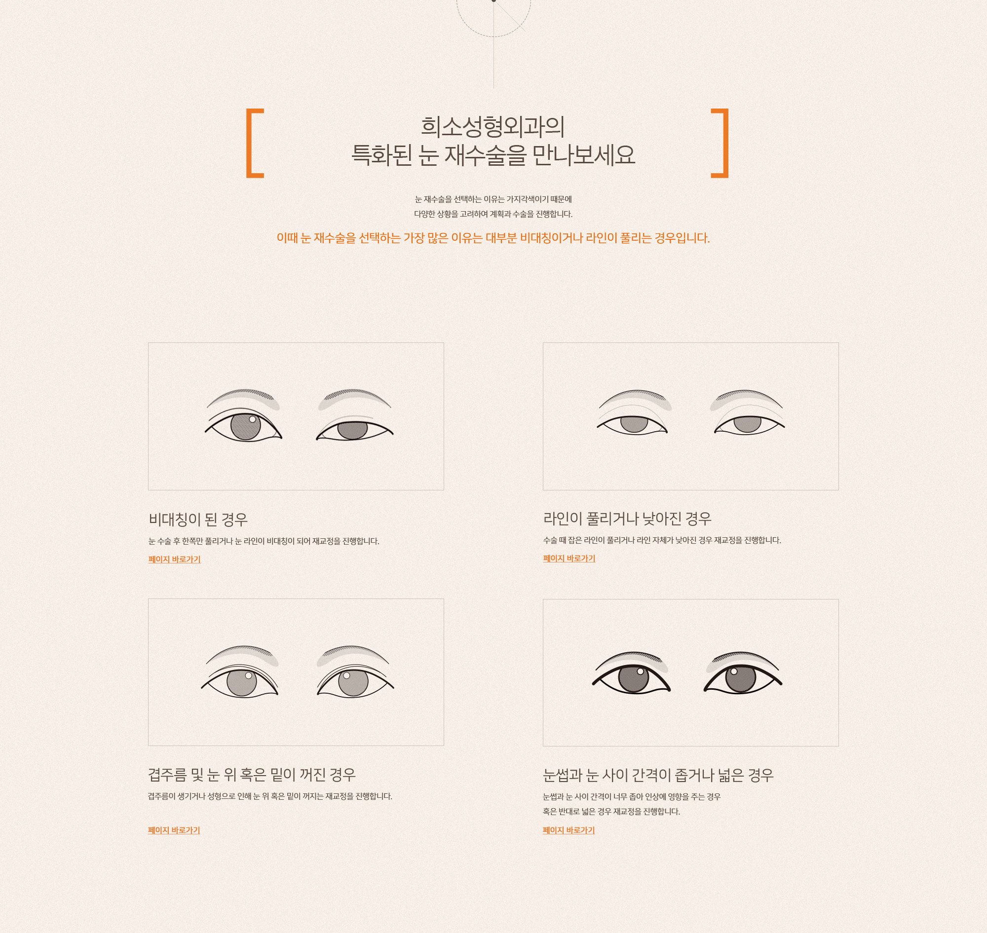 눈성형 철학