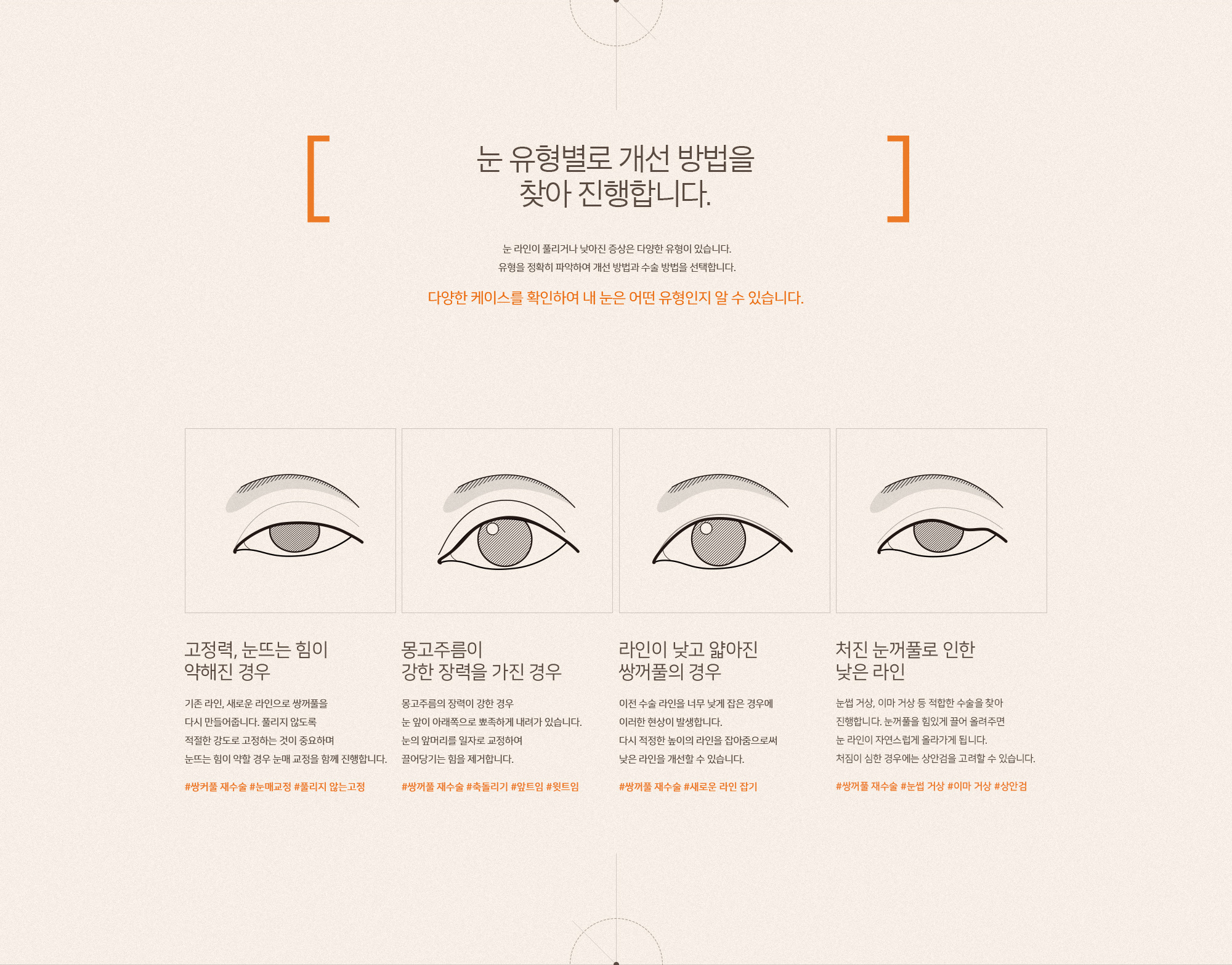 라인 풀림, 낮아짐