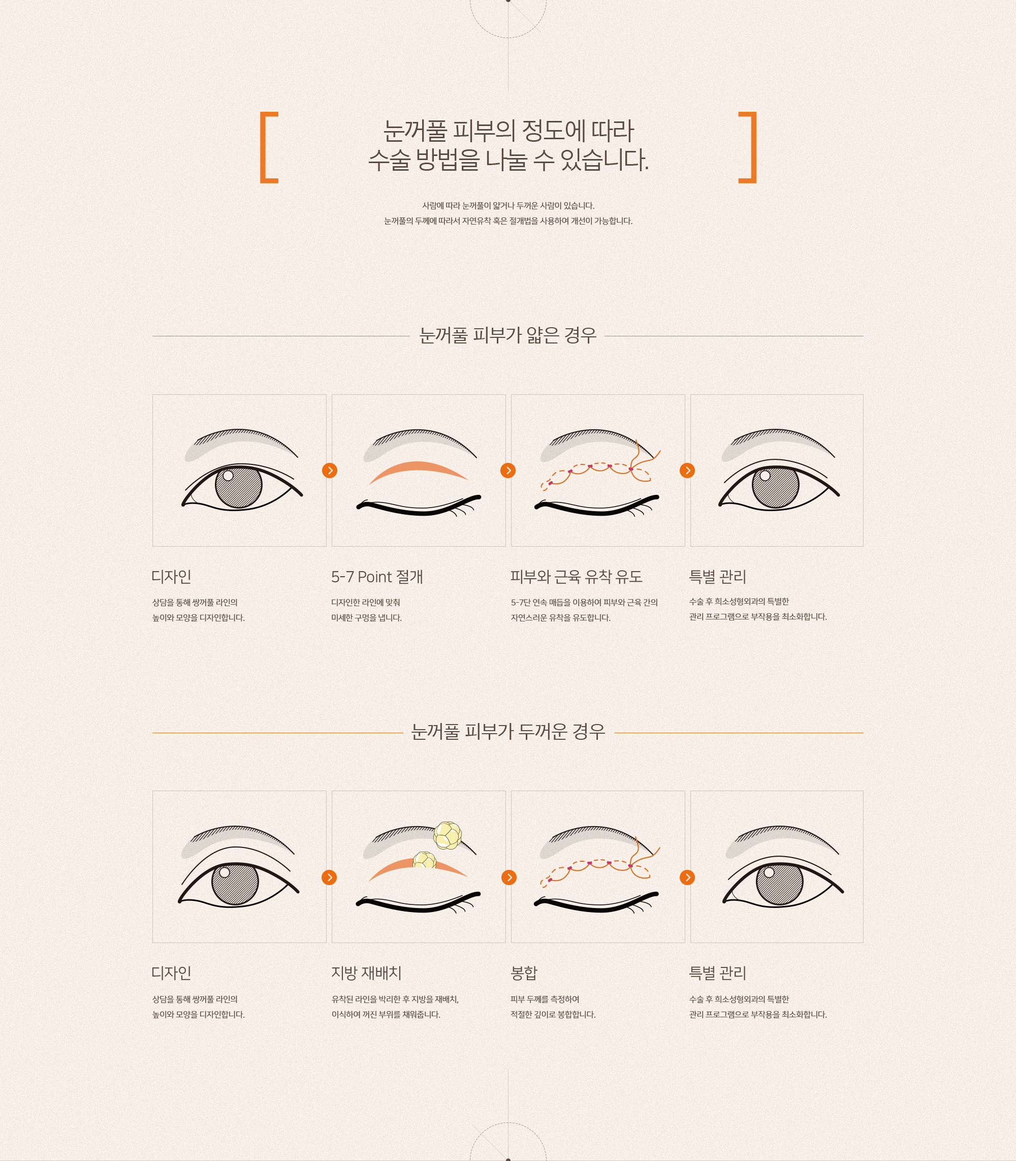 겹주름 및 눈 위, 밑 꺼짐