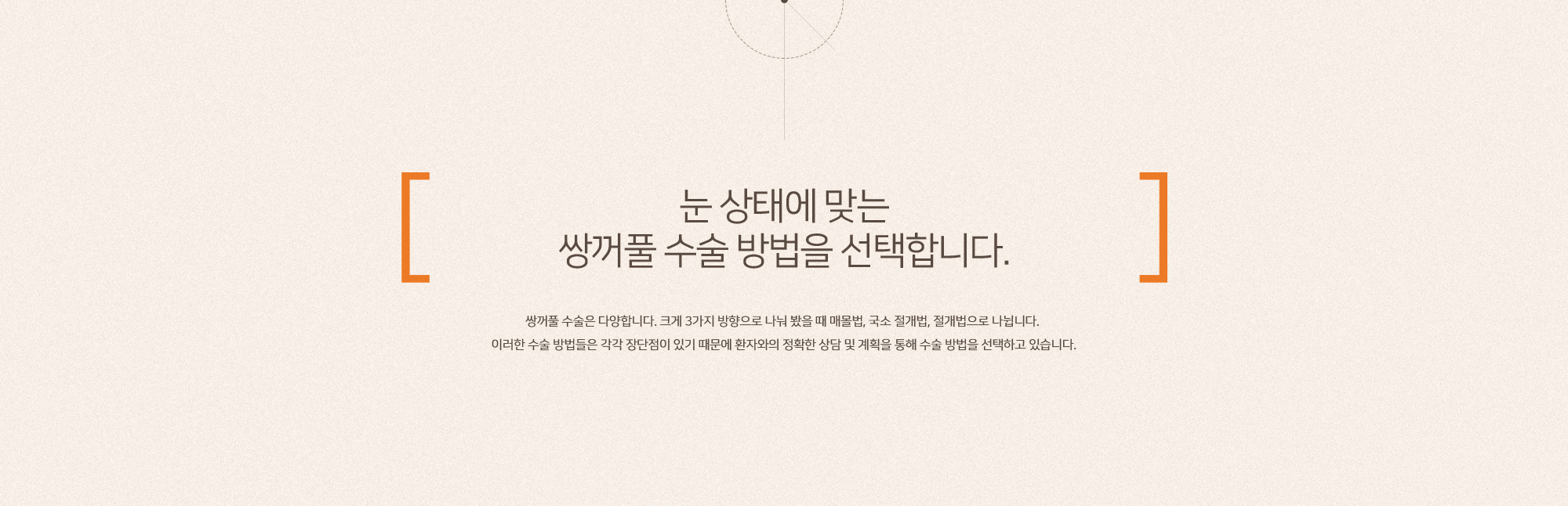 쌍꺼풀