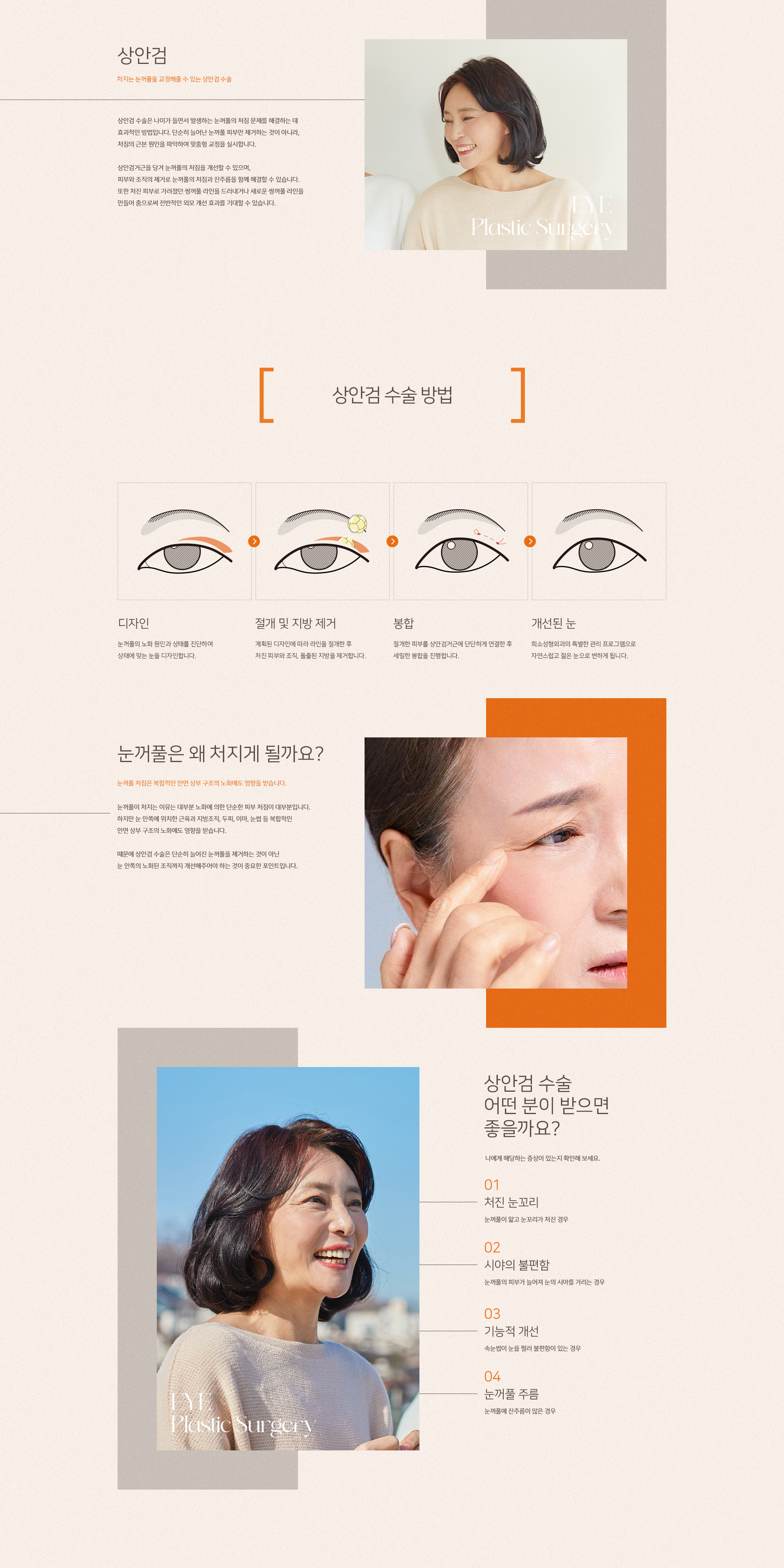 희소성형외과 상안검