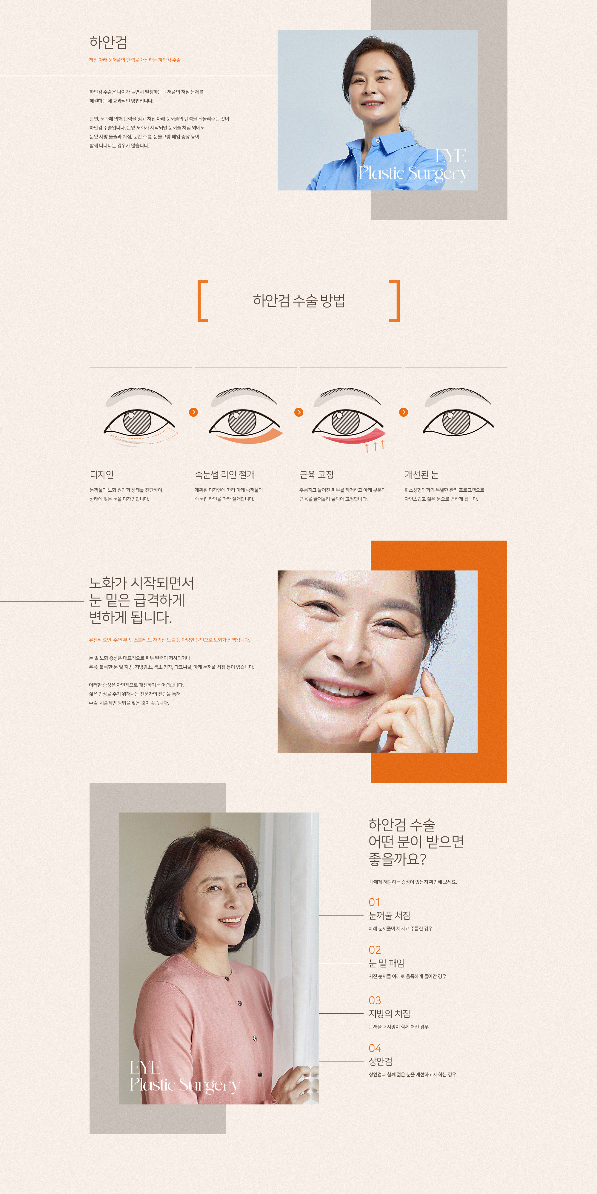 희소성형외과 하안검
