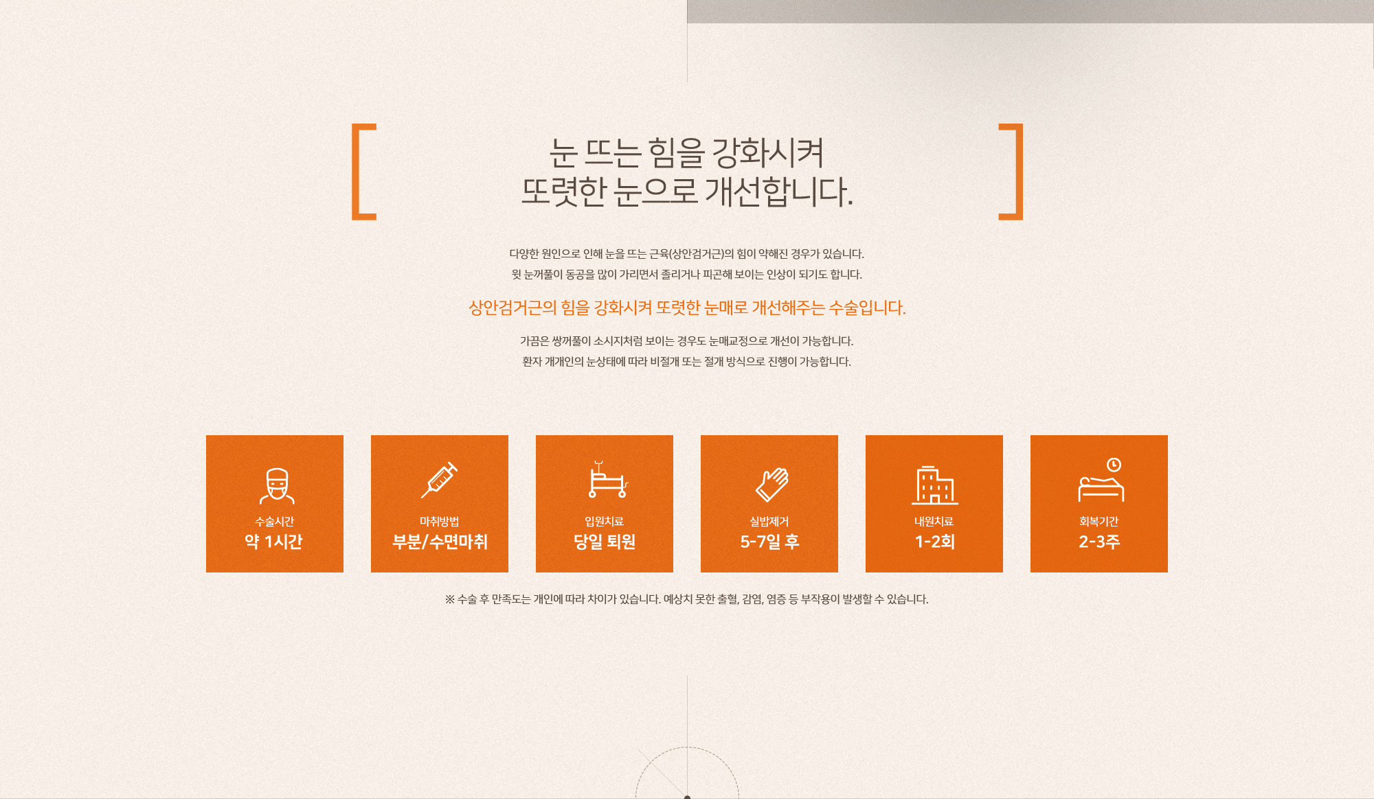 눈매교정