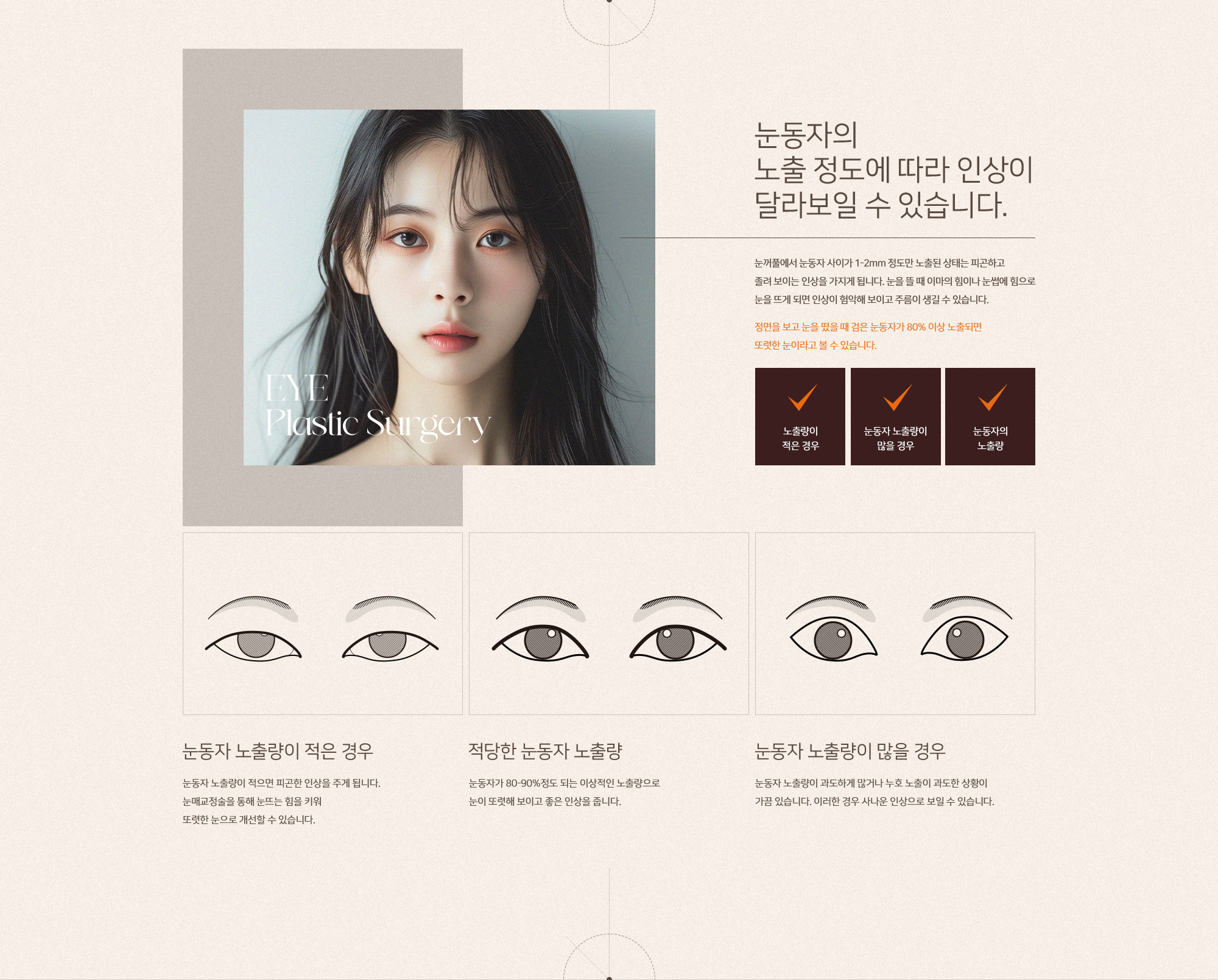 눈매교정