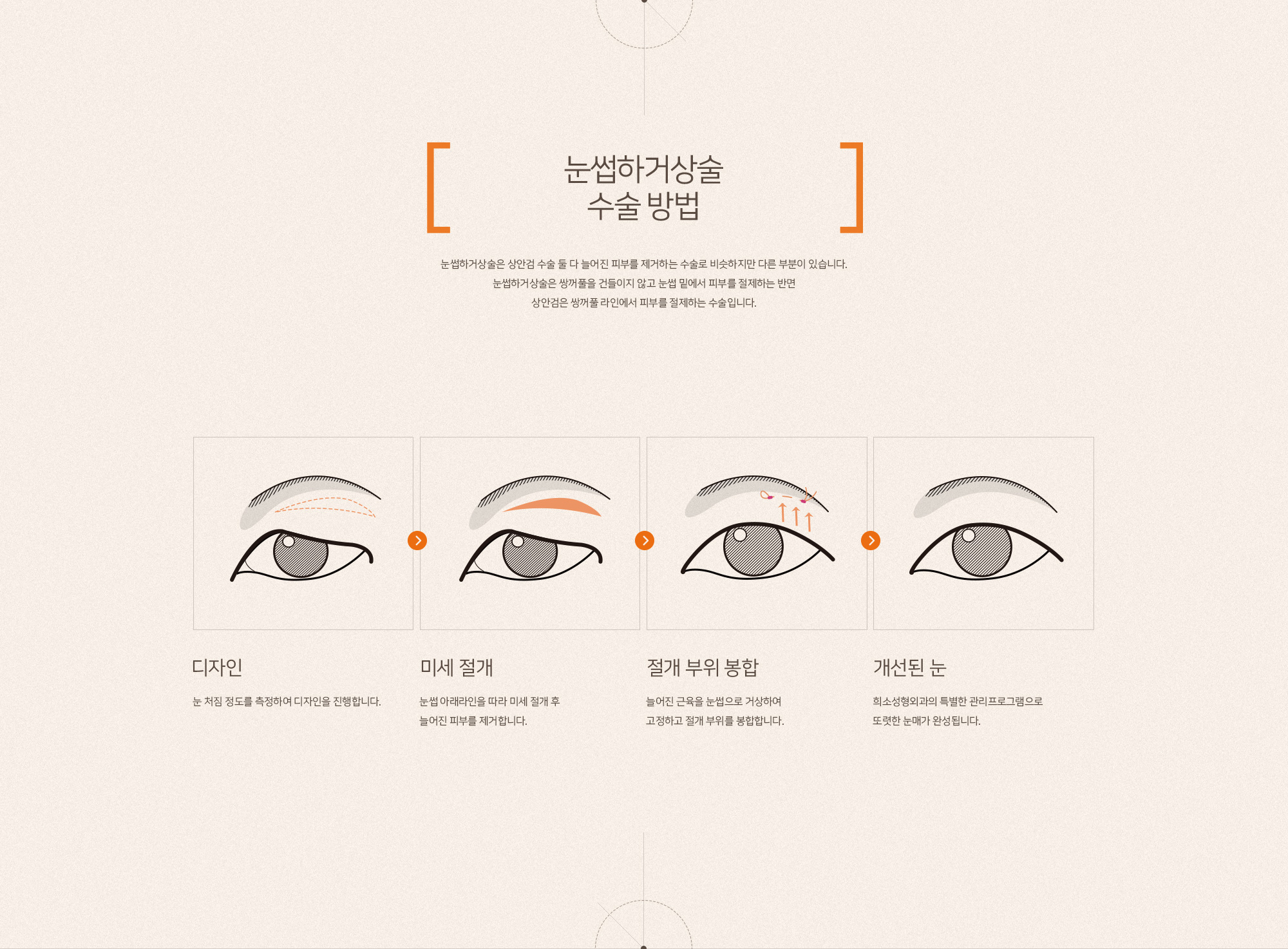 눈썹하거상