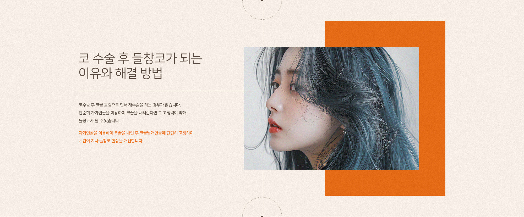 코 재수술