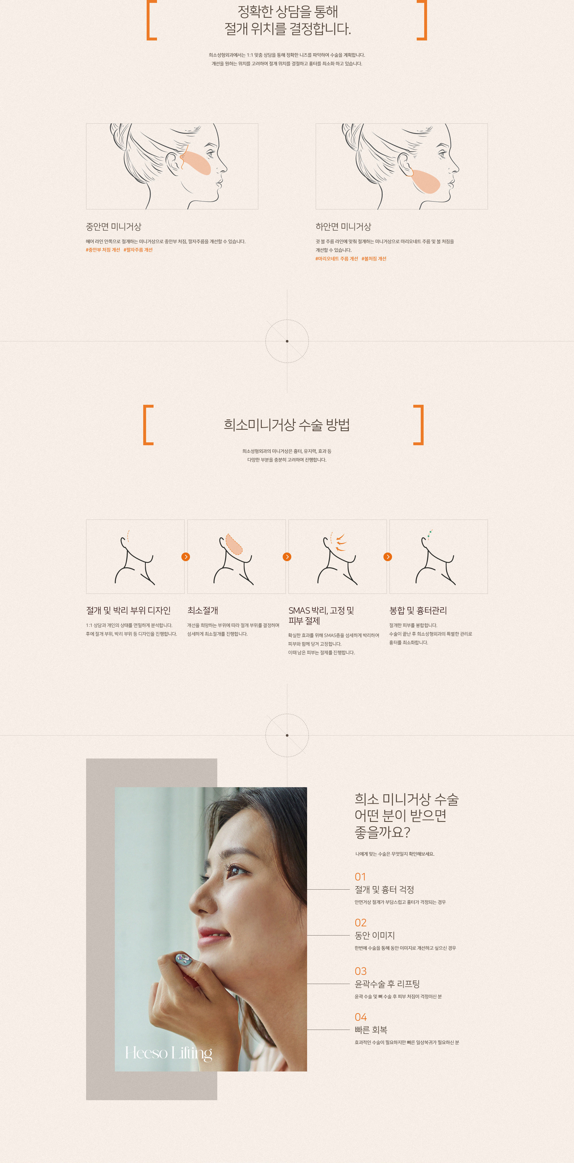 희소 미니거상