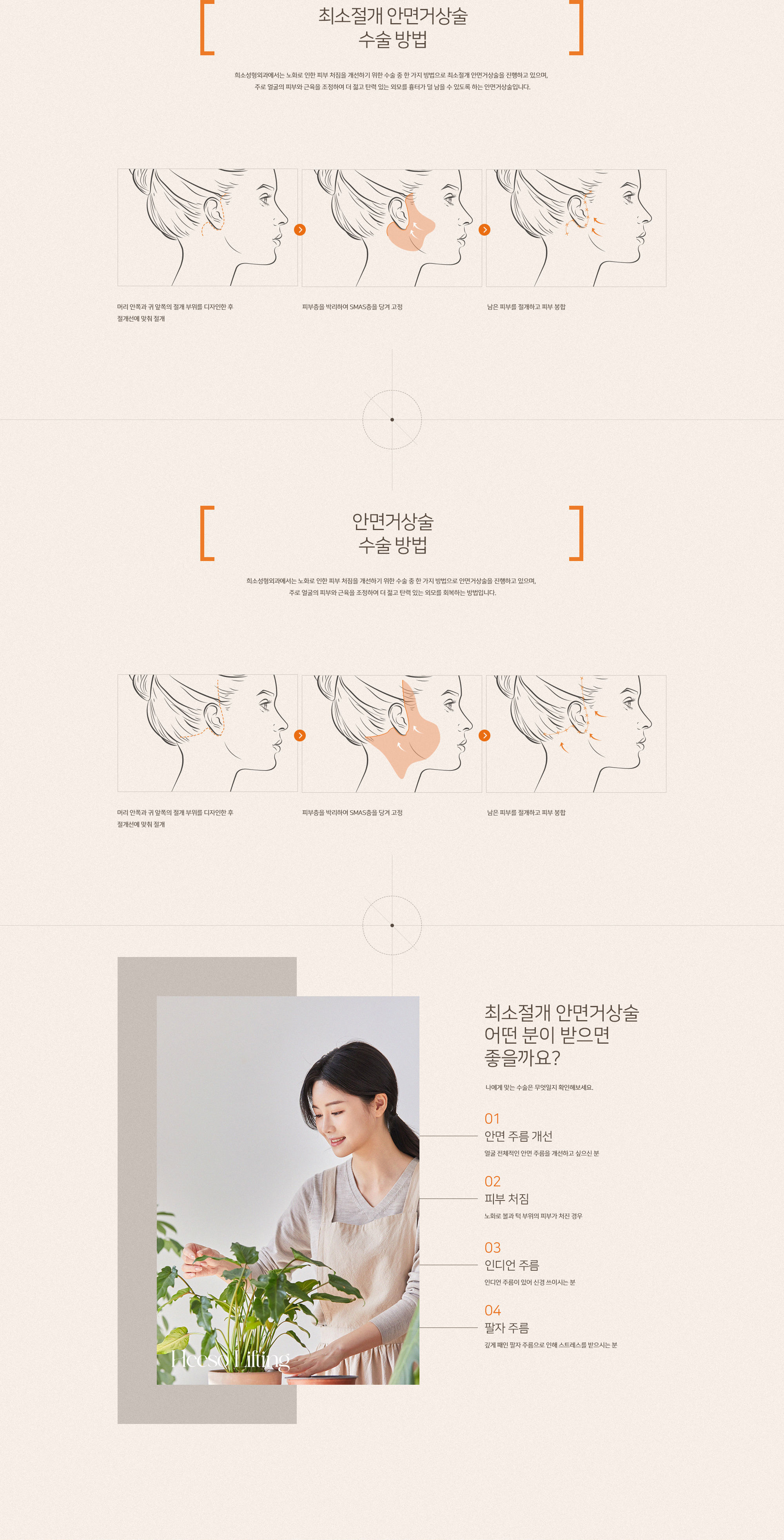 최소절개 안면거상