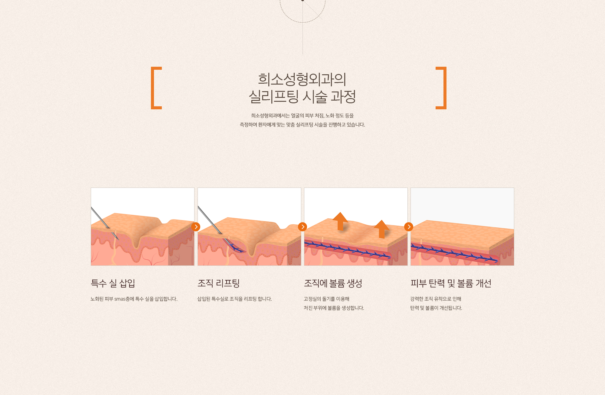 수면 실리프팅