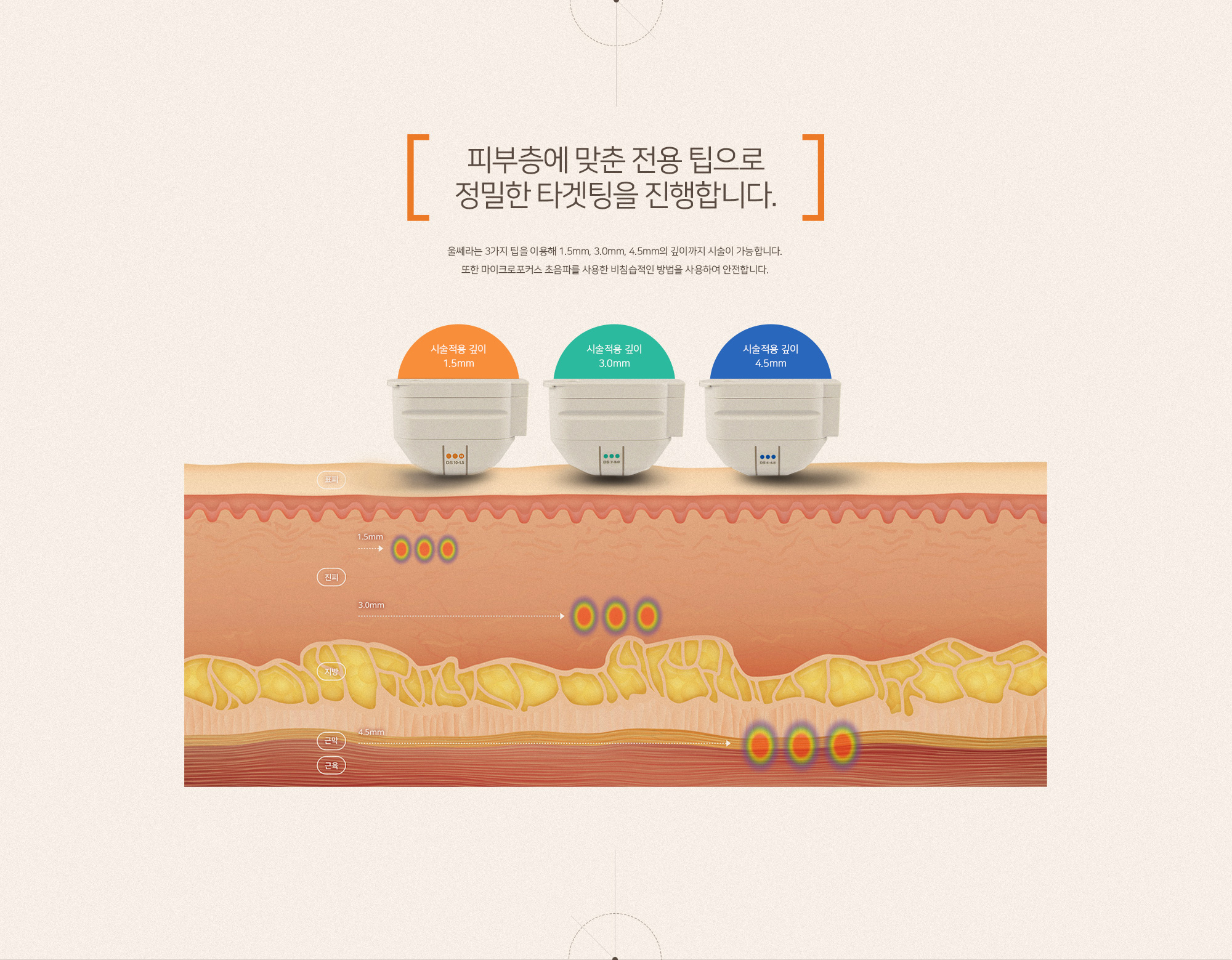 수면 울쎄라