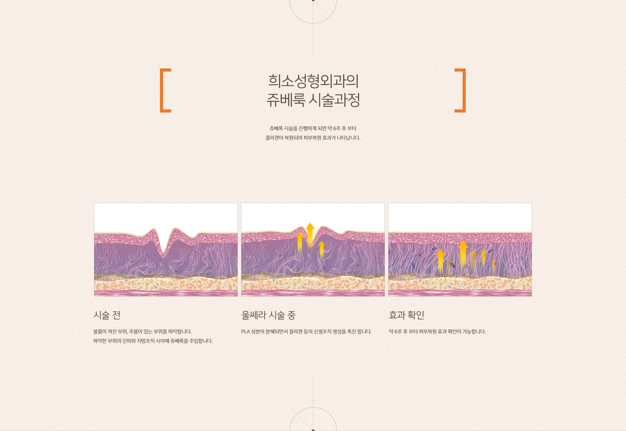 수면 쥬베룩